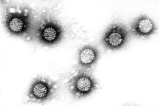 Humane papilloma