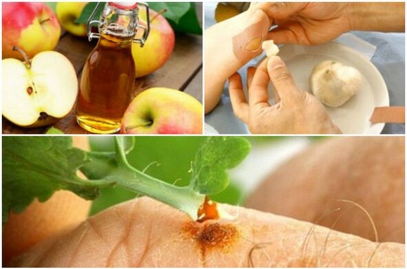 folk remedies warts