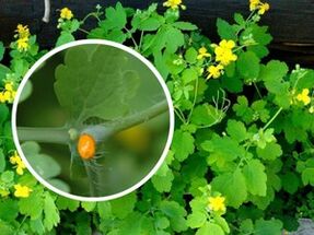 celandine herbal juice to treat plantar warts